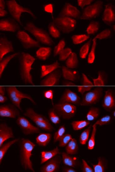Polyclonal Rabbit anti-Human HIF1AN Antibody (IHC, IF, WB)