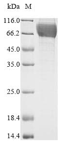 Rat GUCY2C / Guanylyl Cyclase C Protein (Recombinant 10His, N-terminus + Myc, C-terminus)