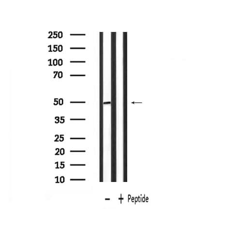 PLAGL1 / ZAC Antibody