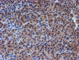 RPS6KB1 / P70S6K / S6K Antibody (clone OTI1G4, Carrier-free)
