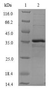 Human CTNNBIP1 / ICAT Protein (Recombinant GST, N-terminus)