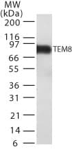 ANTXR1 / TEM8 Antibody (aa481-497, clone 200C1339(SB20))