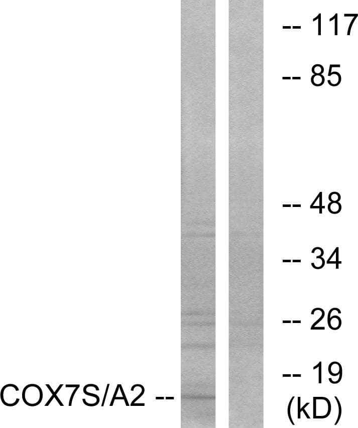 Polyclonal Rabbit anti-Human COX7A2 Antibody (IHC, WB)