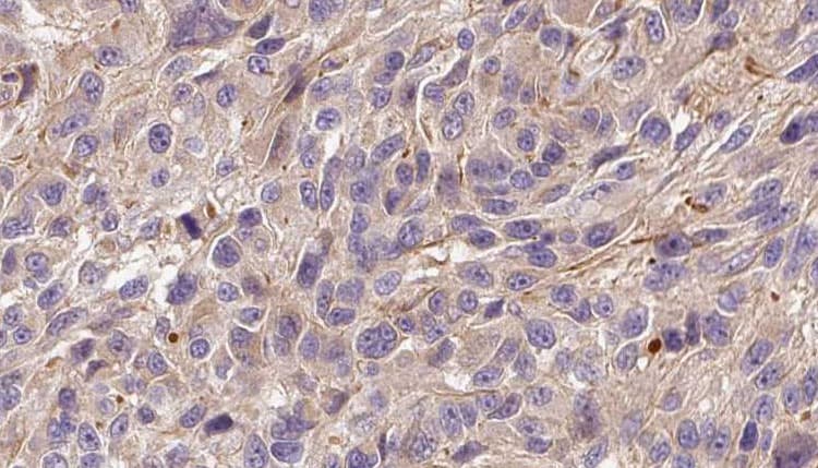 FGF22 Antibody