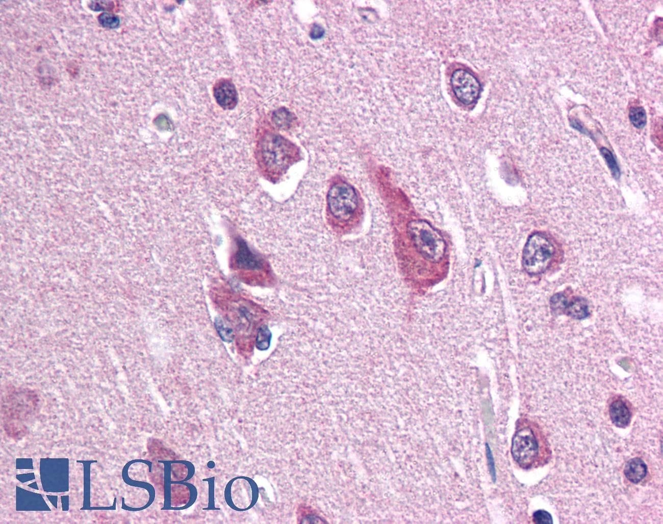 IHC-plus™ SCN2B Antibody (N-Terminus)
