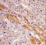 PGK1 / Phosphoglycerate Kinase Antibody (aa305-334)