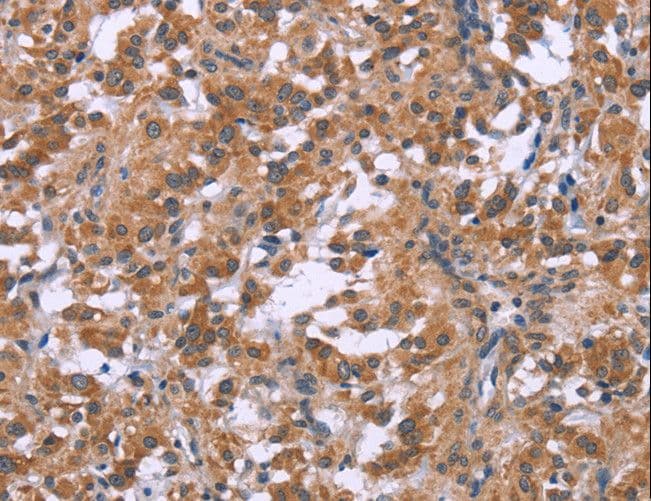 Polyclonal Rabbit anti-Human GNPAT / DHAP-AT Antibody (IHC)