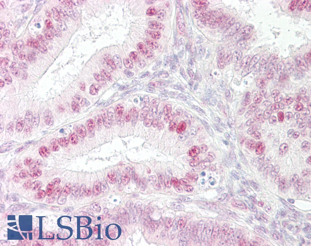 IHC-plus™ ER Alpha / Estrogen Receptor Antibody (aa91-140)