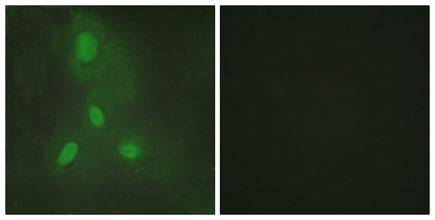 BACH1 Antibody (aa131-180)