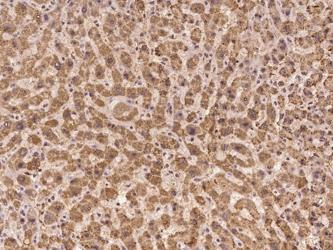 LEKR1 Antibody