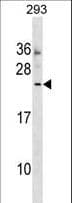 MOSPD3 Antibody (aa86-113)