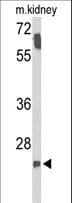 Polyclonal Rabbit anti-Human SMNDC1 Antibody (aa11-41, WB)