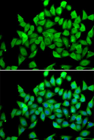 ALS2 / Alsin Antibody