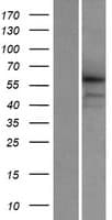 CCDC155 Protein (Over-Expression Lysate Myc-DDK (Flag))