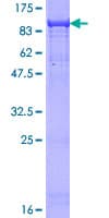 Human ARA70 / NCOA4 Protein (Recombinant GST)