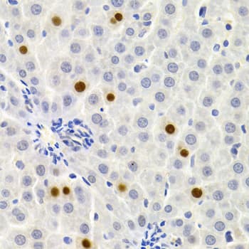 Polyclonal Rabbit anti-Human SIP1 Antibody (IHC, IF, WB)