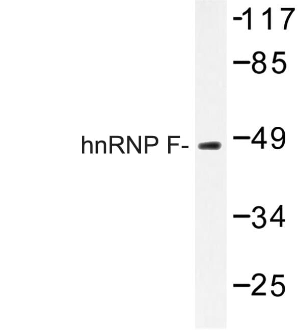HNRNPF / hnRNP F Antibody (Tyr47)
