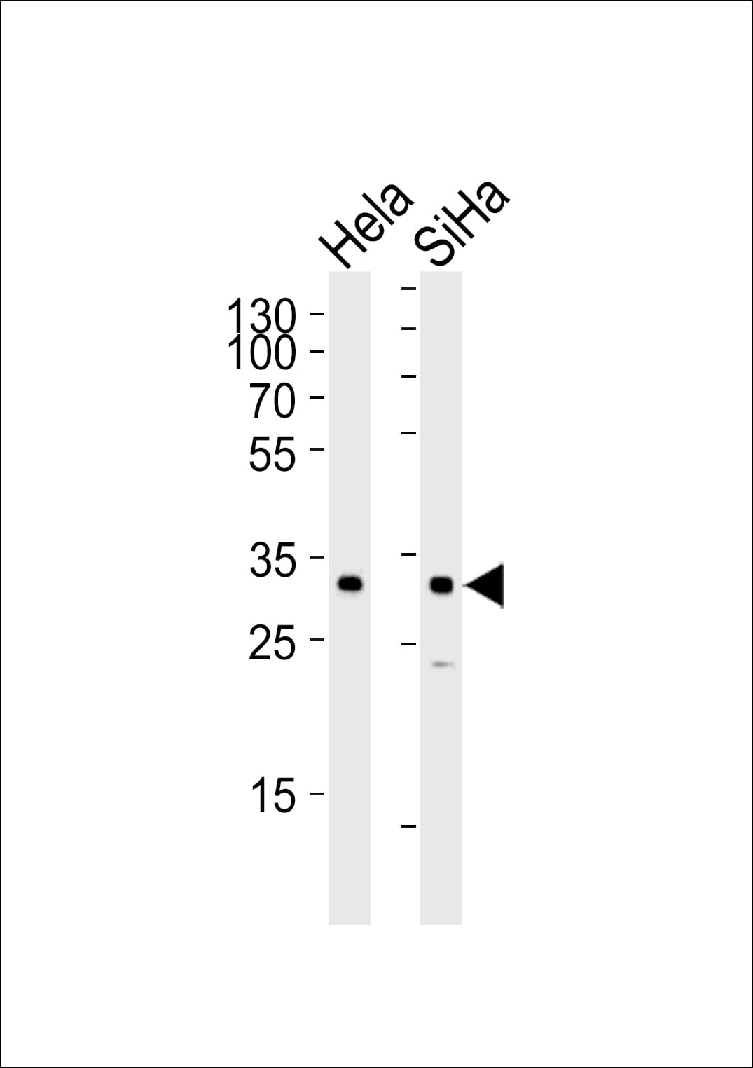SNAI1 / SNAIL-1 Antibody (aa1-30)