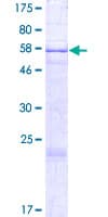 Human NAA16 / NARG1L Protein (Recombinant GST)