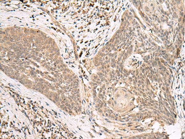 LGALSL / Galectin 5 Antibody