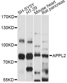 Polyclonal Rabbit anti-Human APPL2 Antibody (WB)