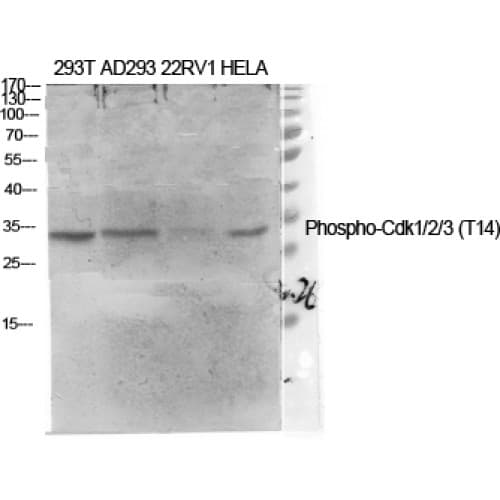 CDC2 + CDK2 + CDK3 Antibody (1-80 aa)