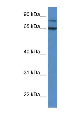 IRAK2 / IRAK-2 Antibody (C-Terminus)