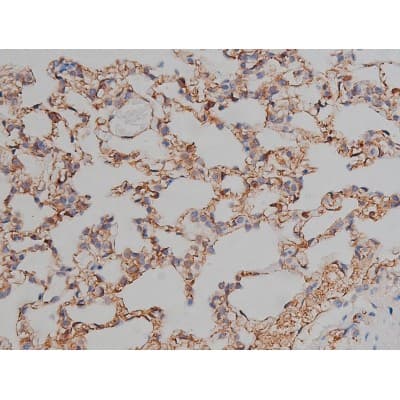 MAPT / Tau Antibody (phospho-Ser404)
