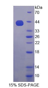 Human IMP-3 / IGF2BP3 Protein (Recombinant His-T7)