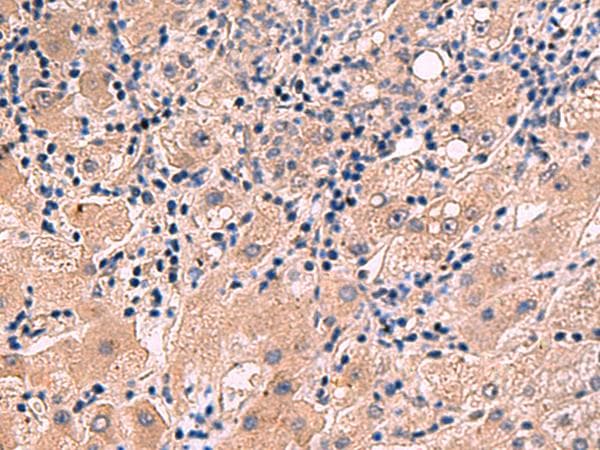 IA-6 / INSM2 Antibody