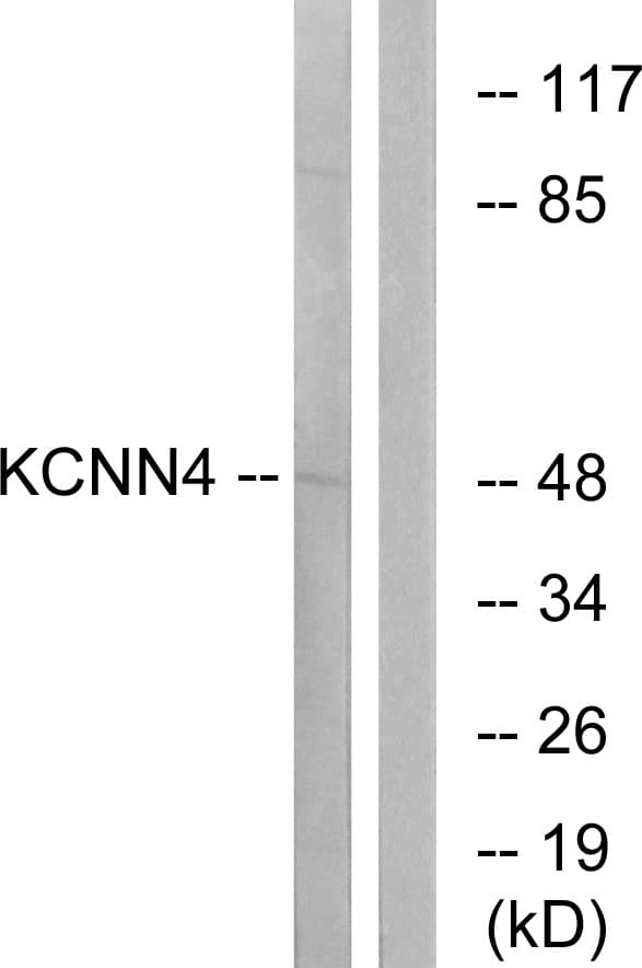 Polyclonal Rabbit anti-Human KCNN4 / KCa3.1 Antibody (aa331-380, WB)