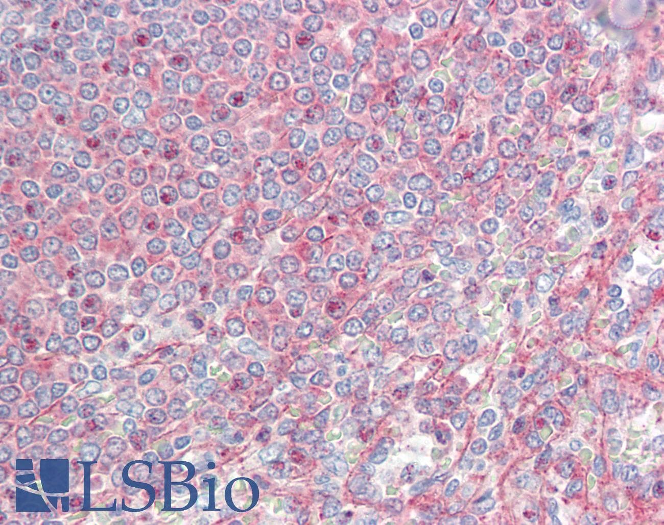 IHC-plus™ MTCL1 / SOGA2 Antibody (aa13-202)