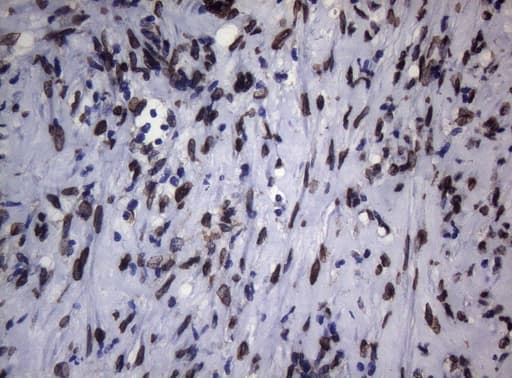 BCL6 Antibody (aa1-300, clone OTI1C3, Carrier-free)