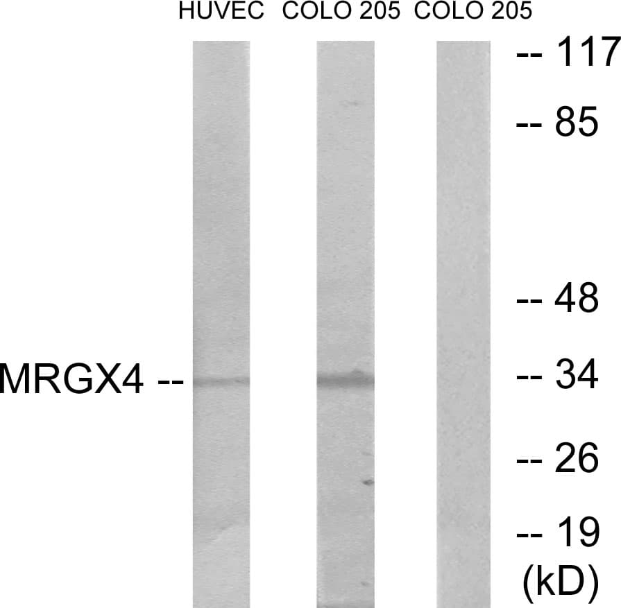 MRGPRX4 / MRGX4 Antibody (aa271-320)