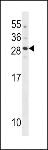 GCAP2 / GUCA1B Antibody (aa29-57)