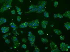 ATP5B / ATP Synthase Beta Antibody (clone OTI7F4)