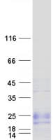 Human ZNF581 Protein (Recombinant Myc-DDK (Flag))