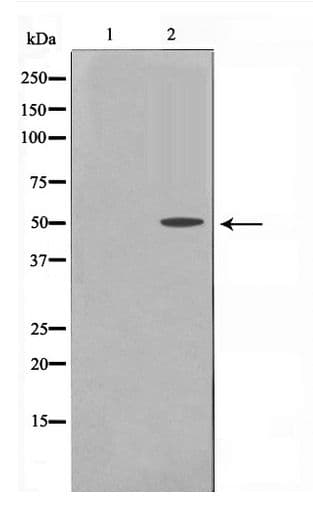 KRT16 / CK16 / Cytokeratin 16 Antibody