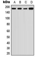 Polyclonal Rabbit anti-Human A2M / Alpha-2-Macroglobulin Antibody (Internal, WB)