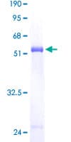 Human PCTP Protein (Recombinant GST)
