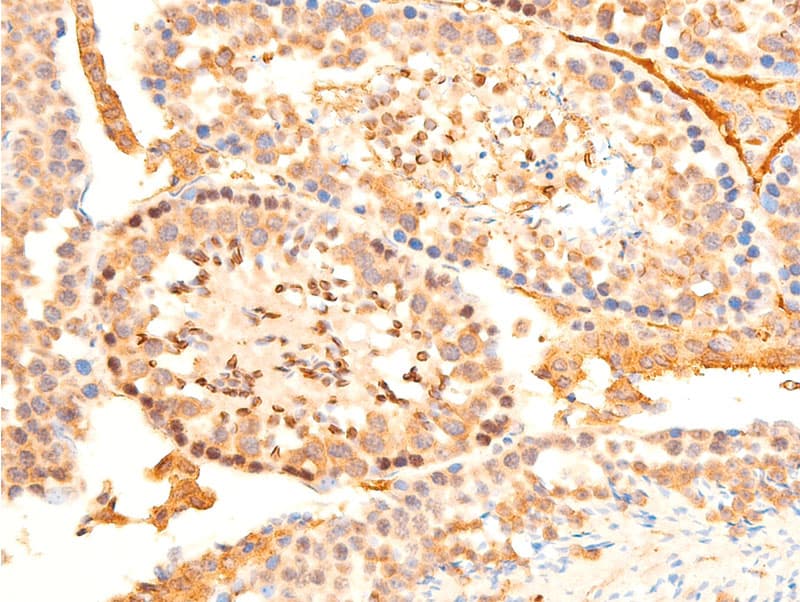 SGK1 / SGK Antibody (phospho-Ser422)