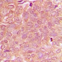 Polyclonal Rabbit anti-Human NBEAL1 Antibody (Internal, IHC, WB)