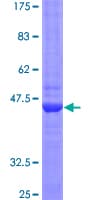 Human LTA / TNF Beta Protein (Recombinant GST)