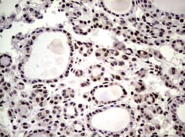Monoclonal Mouse anti-Human NBN / Nibrin Antibody (clone OTI8E7, IHC, WB)