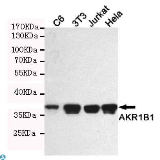 Monoclonal Mouse anti-Human AKR1B1 / Aldose Reductase Antibody (WB)