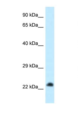 Polyclonal Rabbit anti-Human RASL11B Antibody (aa168-217, WB)