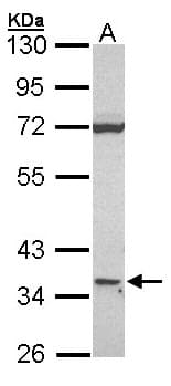 IHC-plus™ Polyclonal Rabbit anti-Human CD1D Antibody (Internal, IHC, WB)
