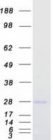 Human RNF11 Protein (Recombinant Myc-DDK (Flag))