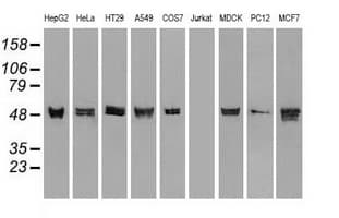 KRT8 / CK8 / Cytokeratin 8 Antibody (clone OTI1B12)