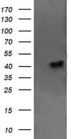 Monoclonal Mouse anti-Human CATIP / C2orf62 Antibody (clone OTI2E6, IHC, IF, WB)